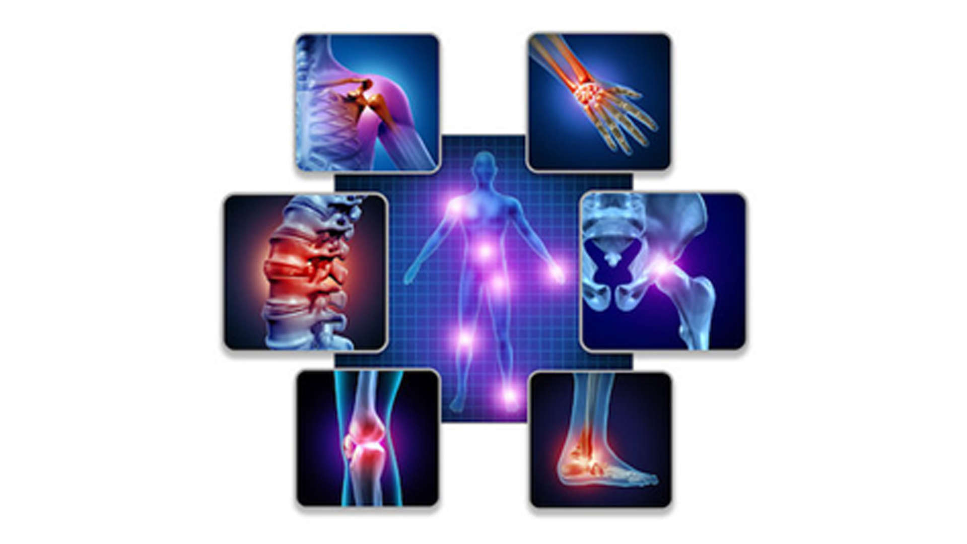 what-are-musculoskeletal-injuries-and-why-is-physiotherapy-important